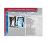 2025-26 Topps Chrome Basketball Breaker's Delight 6-Box Case